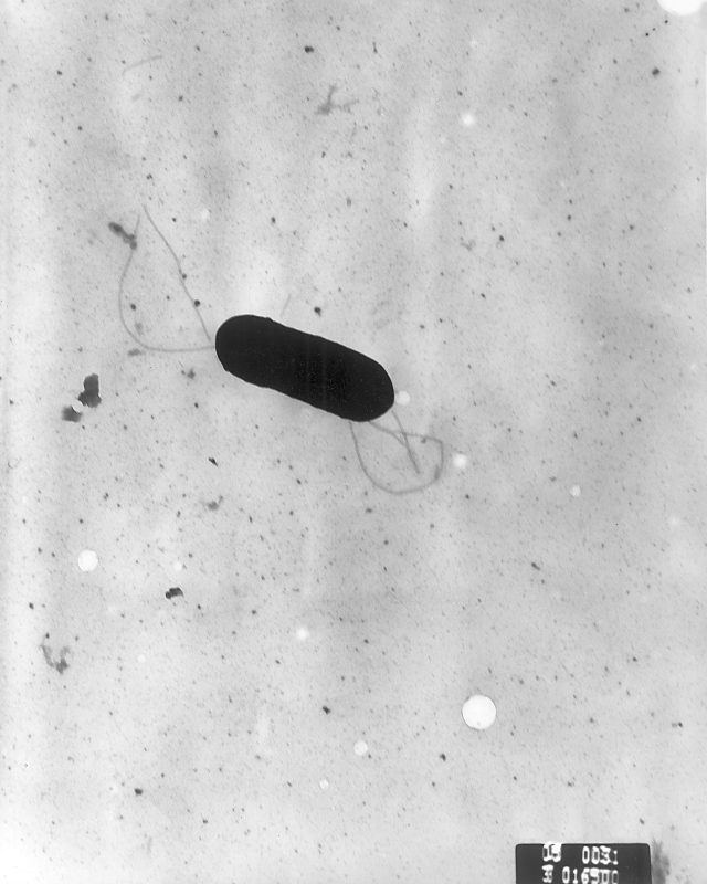 California Listeria Outbreak Linked to Ready-to-Eat Meat Products A medical professional holds a sample of ready-to-eat meat products in a laboratory, testing for listeria contamination.